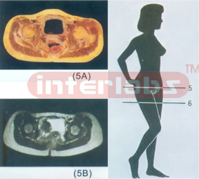 ANATOMICAL DISL MODEL OF FEMALE HUMAN TORSO Section 5